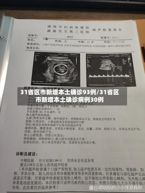 31省区市新增本土确诊93例/31省区市新增本土确诊病例30例-第1张图片